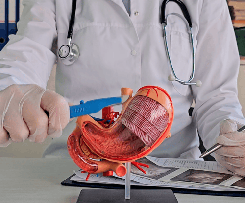 REELS-FEED_BARIATRICA 2